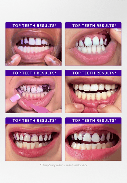 Teeth Whitening Strips